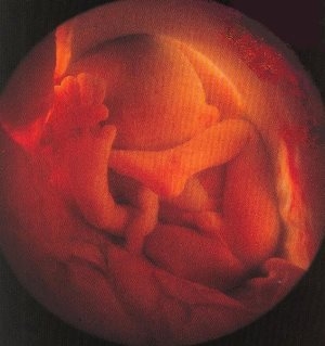 Фото плода на 28 неделе беременности (возраст плода 26 недель)