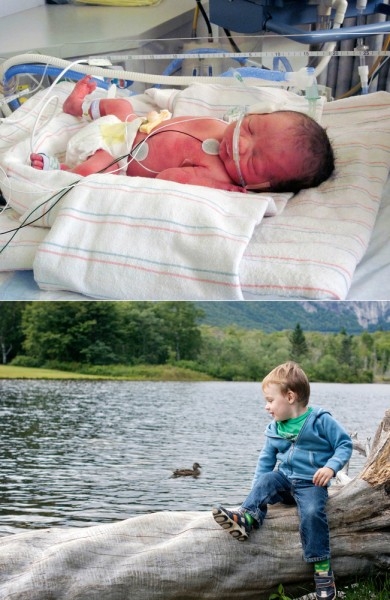 Фото детей рожденных на 34 неделе беременности и фото после