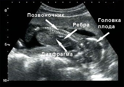 Фото УЗИ 16 неделя беременности