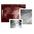 Фото узи беременности по неделям с описанием и фото