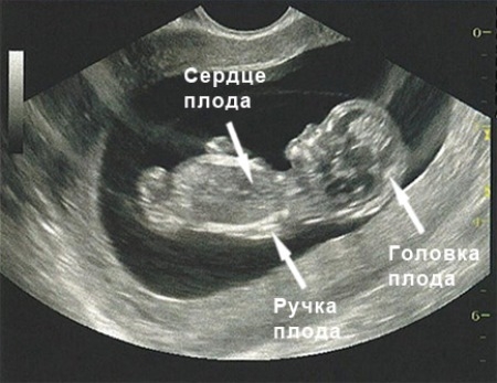 УЗИ на 9 неделе беременности