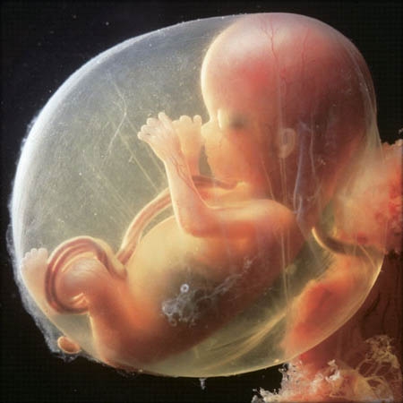 Фото плода на 15 неделе беременности (возраст плода 13 недель)