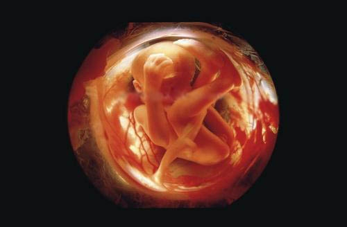 Фото плода на 26 неделе беременности (возраст плода 24 недели)