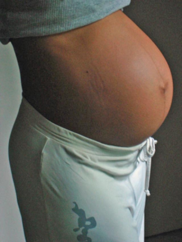 Фото живота на 33 неделе беременности