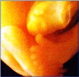 7 неделя беременности развитие плода